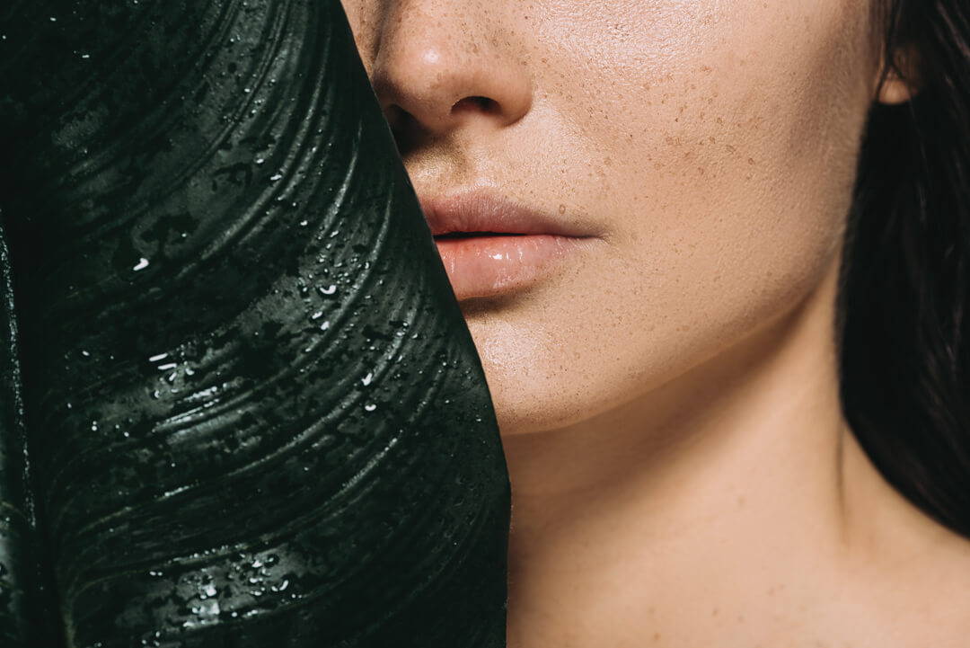 Periorale Dermatitis loswerden